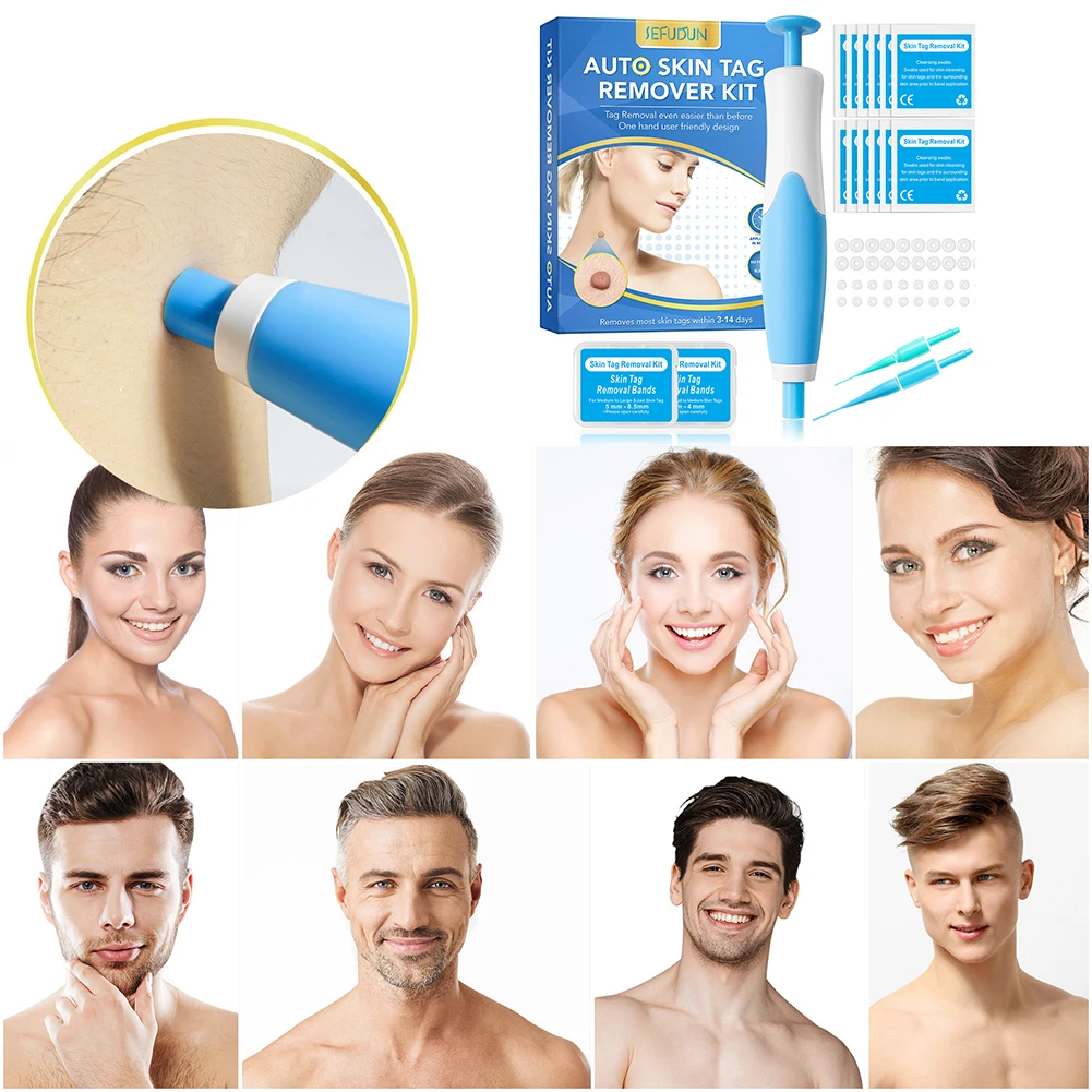 GlowMax™ TagStrike - Skin Tag Removal Kit